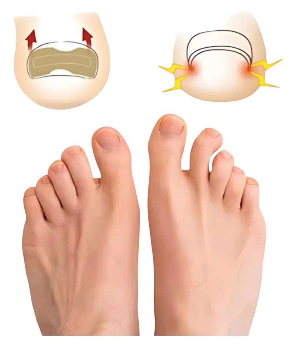 Pack 150 Parches Hongos De Uñas para Pie