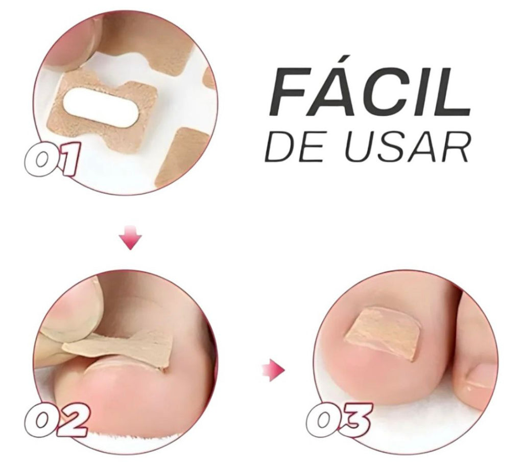 Pack 150 Parches Hongos De Uñas para Pie